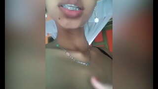 Сверкая այտուցված pussy