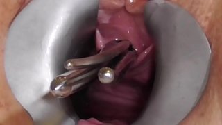 Amatérské FreyjaAnalslut: tyče v Freyja díře